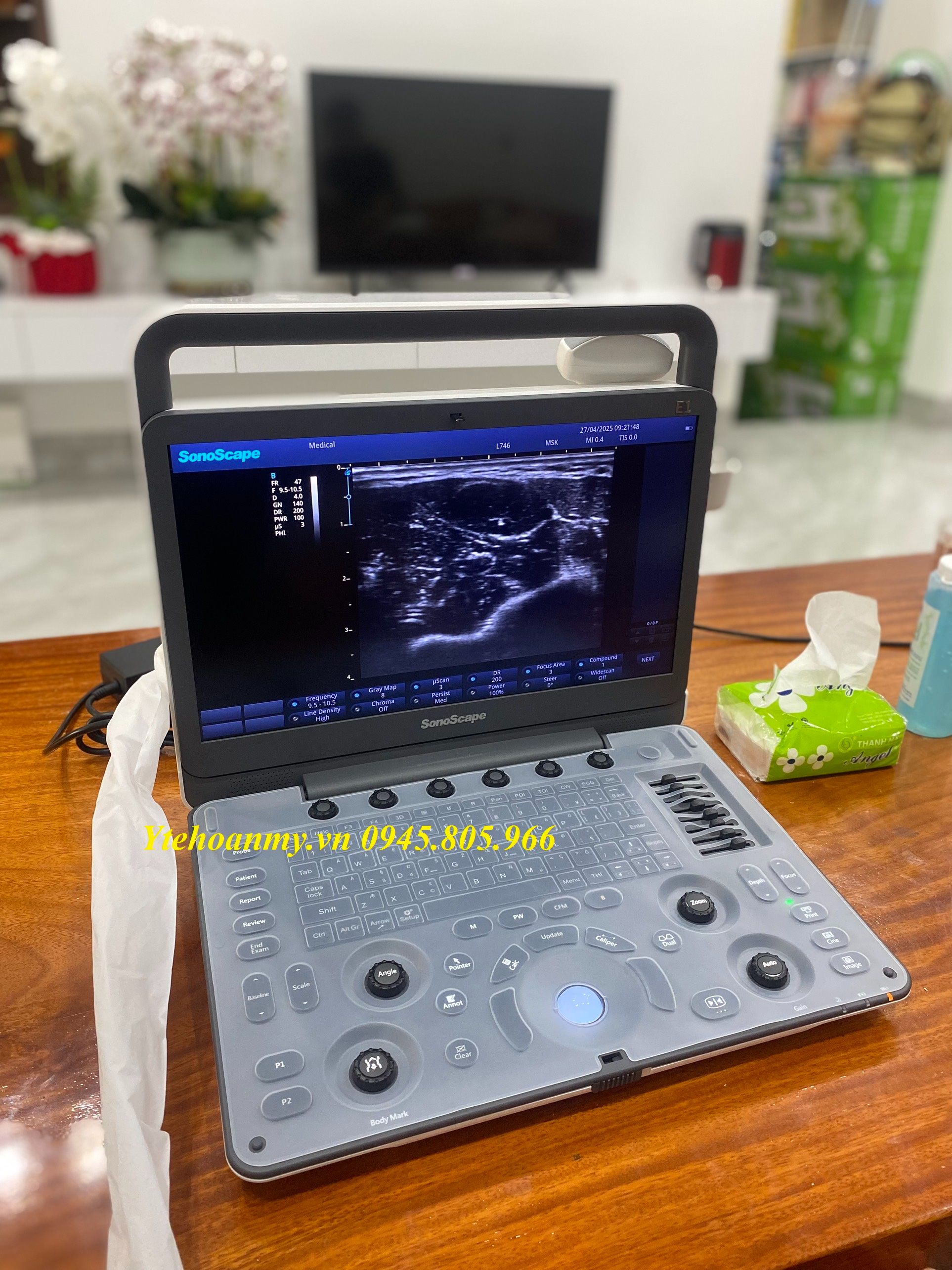 Top 7 máy siêu âm xách tay chất lượng - giá dưới 100 triệu Tại Y Tế Hoàn Mỹ